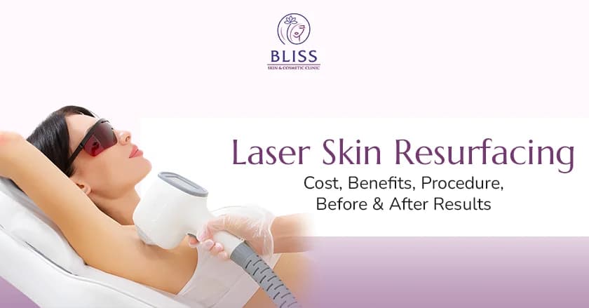 Laser Skin Resurfacing Cost, Benefits, Procedure, Before & After Results