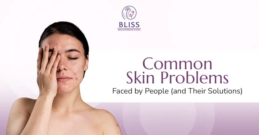 skin problems