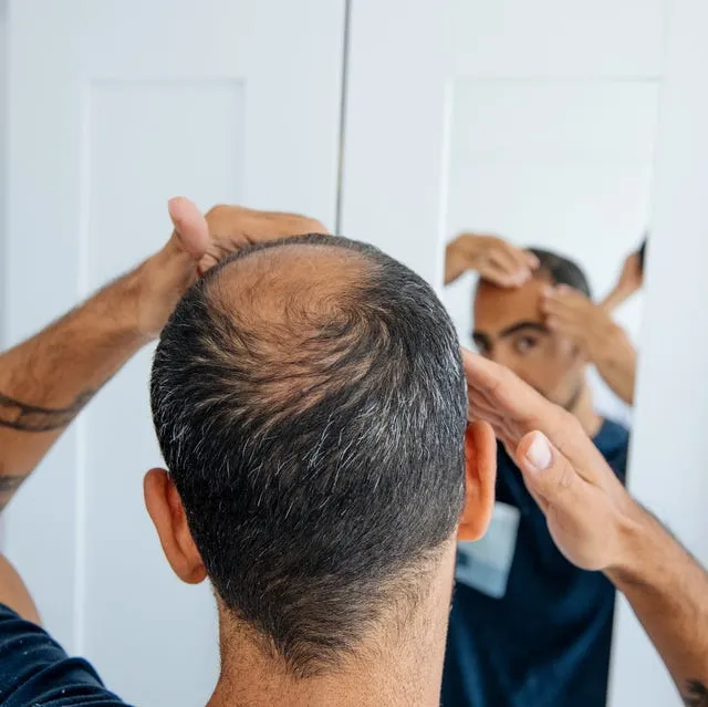 Hair Regrowth Treatment